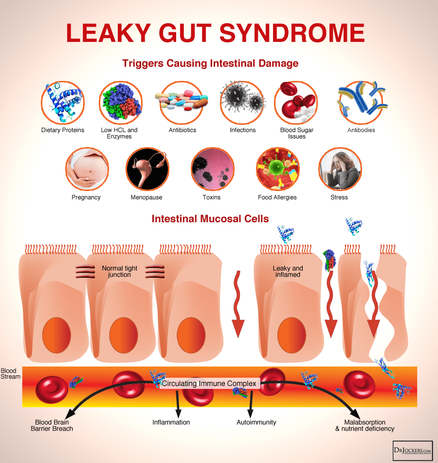 on2-GUTHEALTH_LeakyGutSyndrome