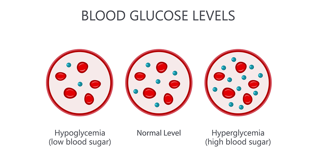 on3-bglevels1