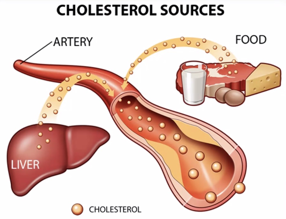 on3-cholesterol4