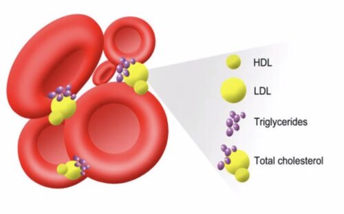 on3-cholesterol5