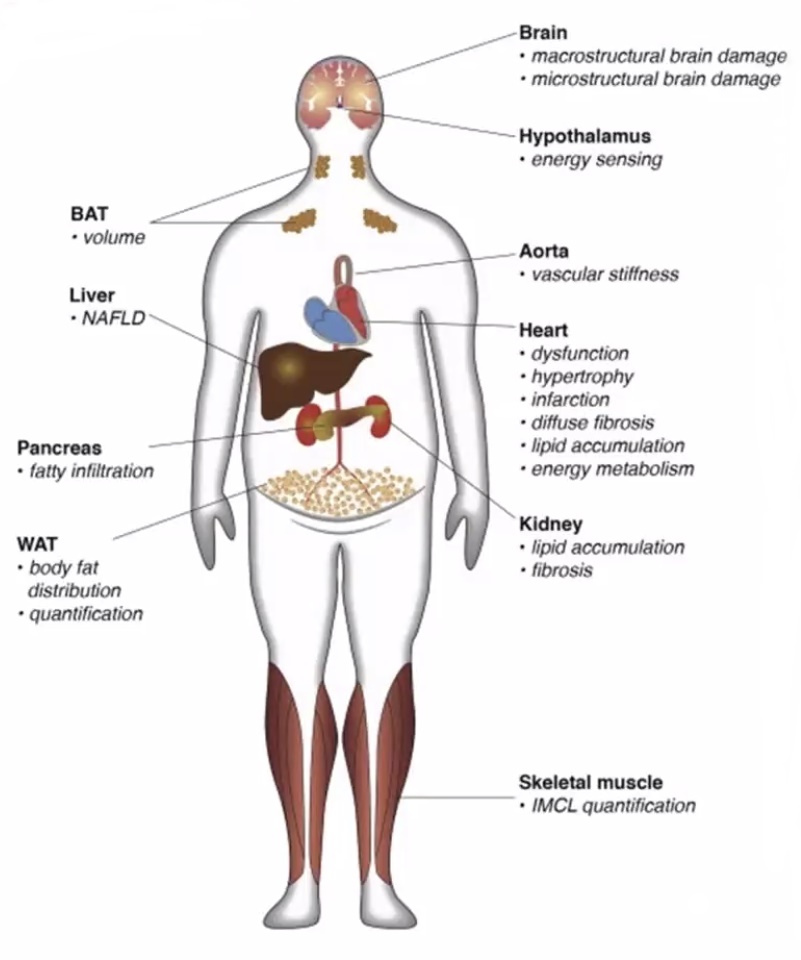 on3-metabolicsyndorome-dna2