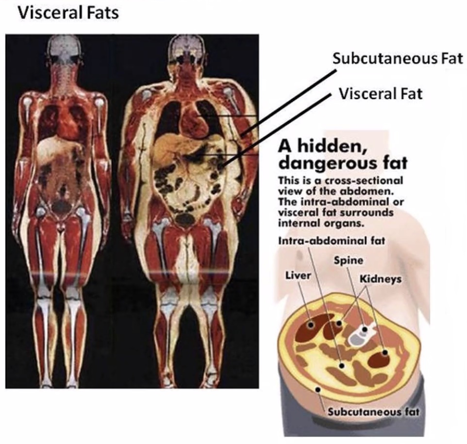 on3-visceralfat1